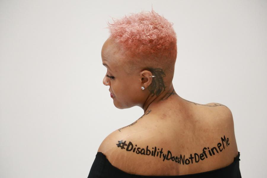 Keisha with her back towards the camera and we can only see her profile. She has pink hair and wearing a black off-shoulder top. “#DisabilityDoesNotDefineMe” is written across her back.